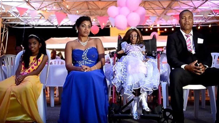 Una niña con progeria supera la adversidad y celebra sus 15 años