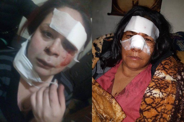 Golpes, denuncias cruzadas y un loteo social que se vendió a otra familia