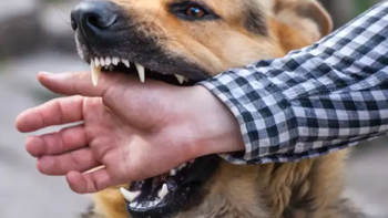 un hombre fue mordido por un perro y la familia debera pagarle terapia durante un ano un hombre fue mordido por un perro y la familia debera pagarle terapia durante un ano