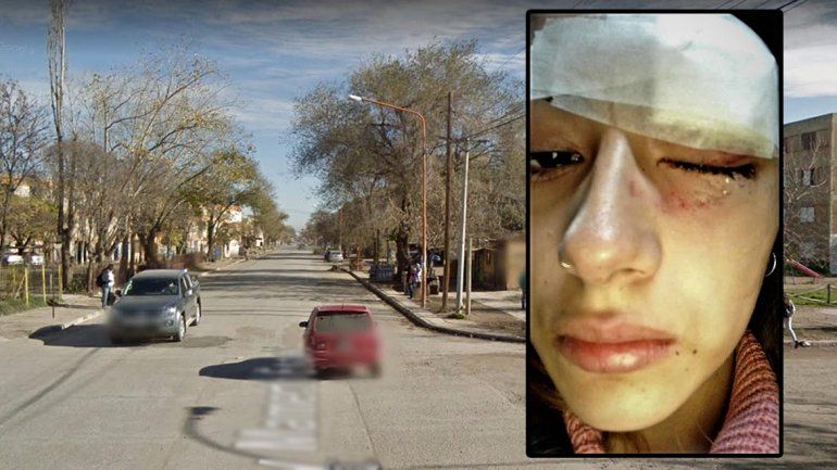 Brutal ataque a una adolescente en Cipolletti: le dieron un piedrazo en la cara para robarle la moto