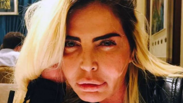 Raquel Mancini, de ícono de belleza de los años '90 a una vida marcada por situaciones médicas