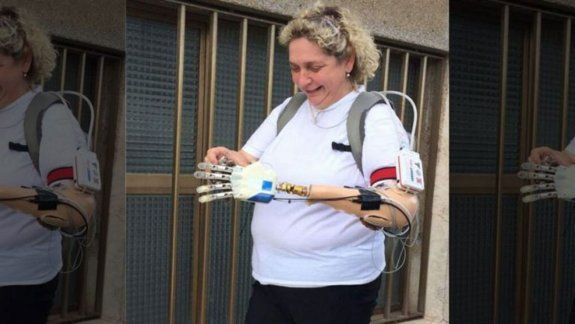 Le implantaron una mano biónica y recuperó el tacto