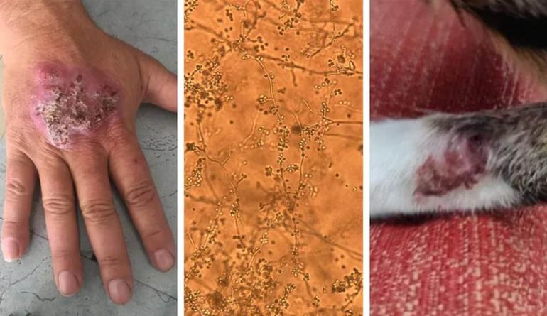 La infección por el hongo puede causar graves lesiones cutáneas y afecta principalmente a menores y adultos mayores. La infección por el hongo puede causar graves lesiones cutáneas y afecta principalmente a menores y adultos mayores.