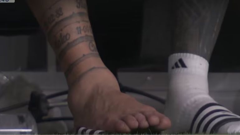 La lesión de Lionel Messi La lesión de Lionel Messi