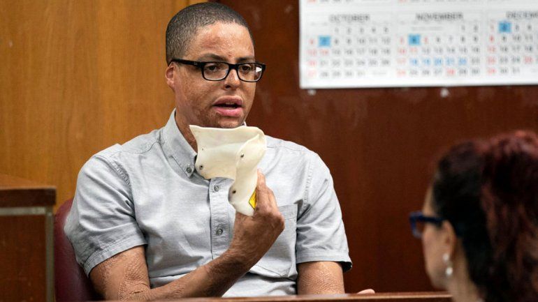 Se quemó en la escuela y cobró u$s 59 millones