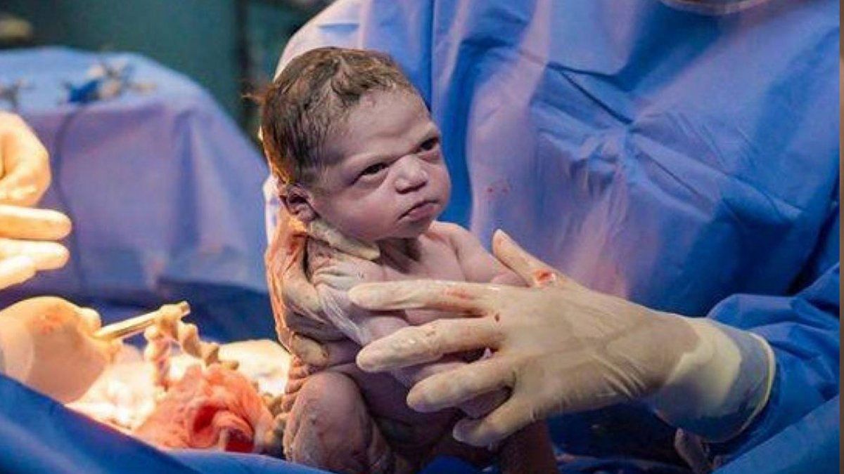 La Historia De La Bebe Que Nacio Con Cara De Muy Enojada