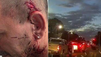 Un conductor agredió con un palo a otro tras un choque. Un conductor agredió con un palo a otro tras un choque.