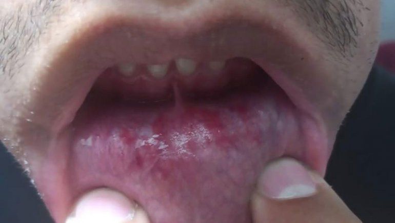 El guardavidas mostró las heridas que sufrió.