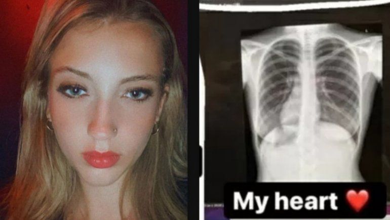 TikTok: joven descubre que tiene el corazón del otro lado.