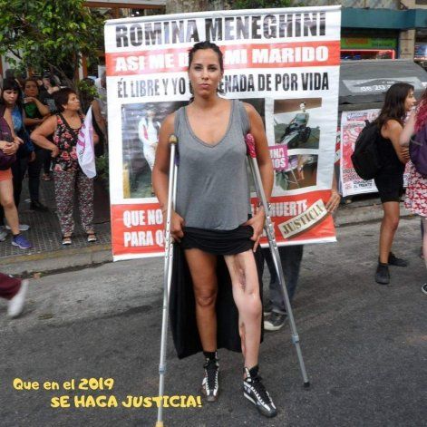 Romina Meneghini con las secuelas del escopetazo en una pierna que le dio Piccinin, ex piloto del TC.