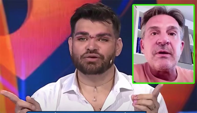 Fran Mariano mostró cómo le quedó la cara tras operarse con Lotocki