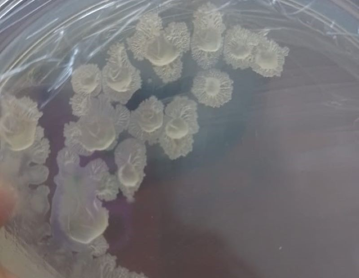 En el INTA investigan una bacteria. Foto: INTA En el INTA investigan una bacteria. Foto: INTA