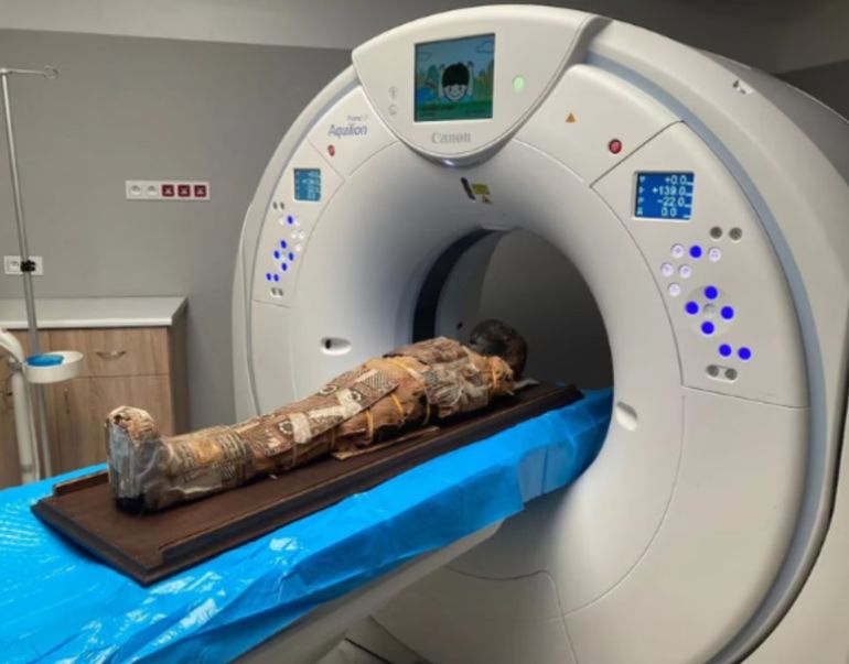 Los estudios determinaron que la momia estudiada en Polonia era de un niño que murió alrededor de los ocho años Los estudios determinaron que la momia estudiada en Polonia era de un niño que murió alrededor de los ocho años