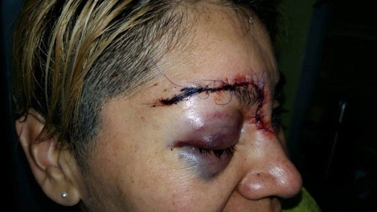 Lo juzgan por desfigurar a una sargento de policía