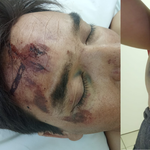 Sebastián es uno de los petroleros que fueron chocados en Ruta 51 y terminó internado en terapia intensiva durante seis días. | LM Neuquen Sebastián es uno de los petroleros que fueron chocados en Ruta 51 y terminó internado en terapia intensiva durante seis días.