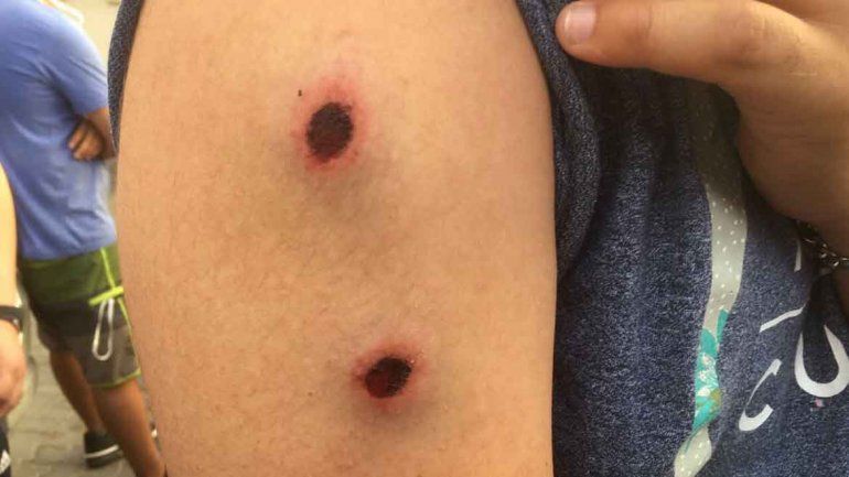 ATE confirmó tres heridos graves por los incidentes