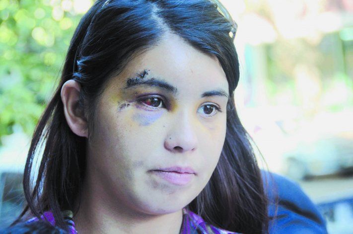 Así quedó Fernanda Pereyra tras el ataque del boxeador Marangel Ademar.