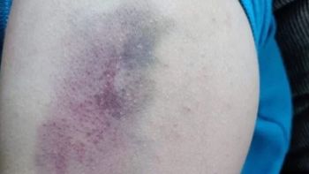 Bullying en Río Gallegos: la mamá del nene denunció a las autoridades de la escuela / Foto La Opinión Austral Bullying en Río Gallegos: la mamá del nene denunció a las autoridades de la escuela / Foto La Opinión Austral