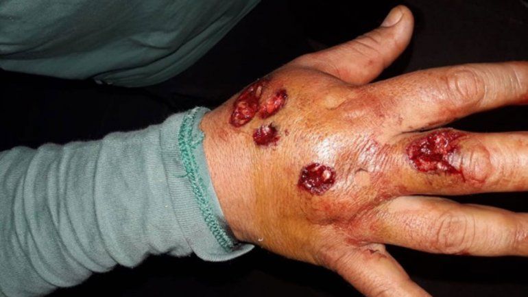 Buscan determinar  si hubo exceso en el uso de balas de goma