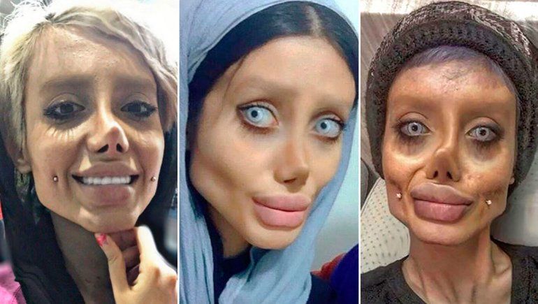 Detienen a la iraní que se operó a lo Angelina Jolie