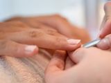 Las 6 lesiones muy peligrosas que puede causar la manicura semipermanente