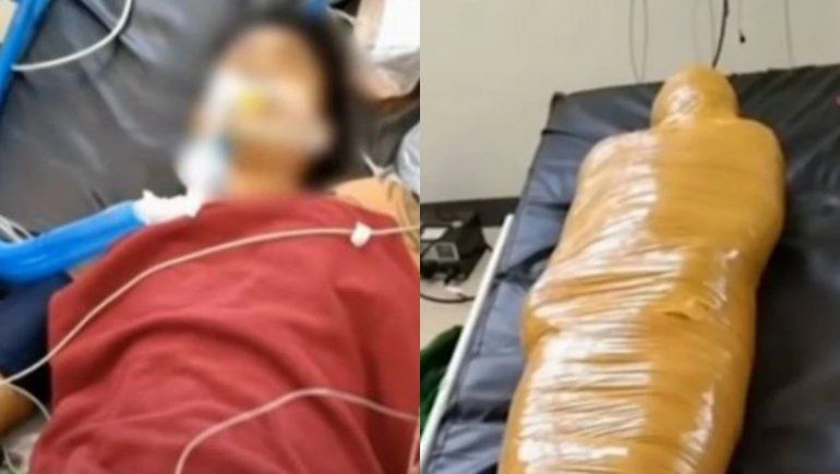 Murió tras ser atendido como paciente con covid-19: estaba herido por un accidente de tránsito