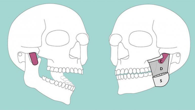 Descubren una nueva capa muscular en la mandíbula humana