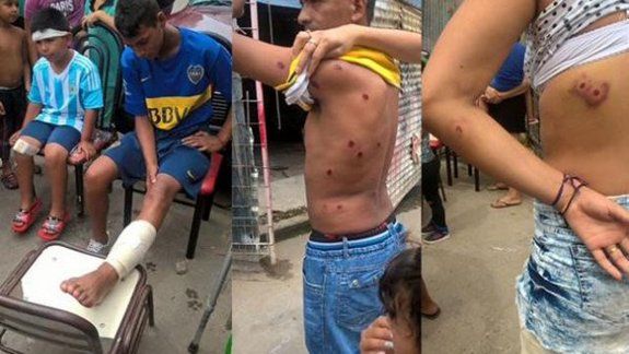 Uno de los jóvenes atacados por gendarmes en la Villa 1-11-14.