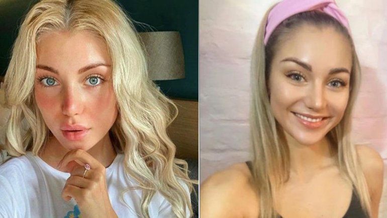 Una modelo rusa criticó a Putin y apareció muerta dentro de una valija