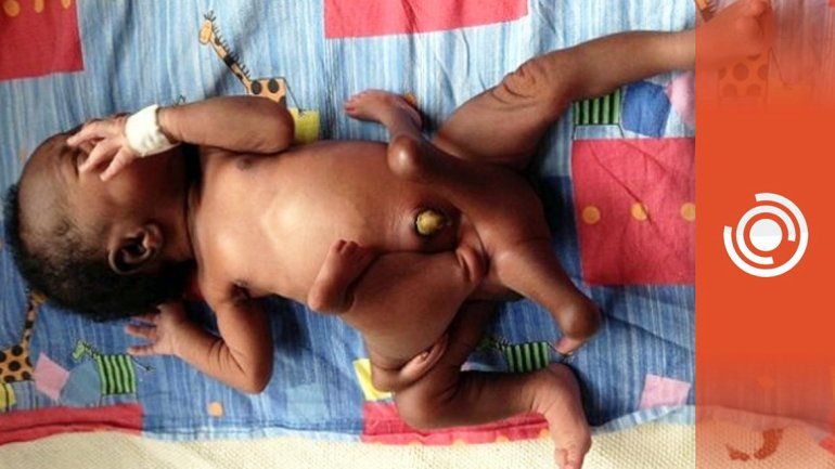 El bebé se llama Karam. En el útero