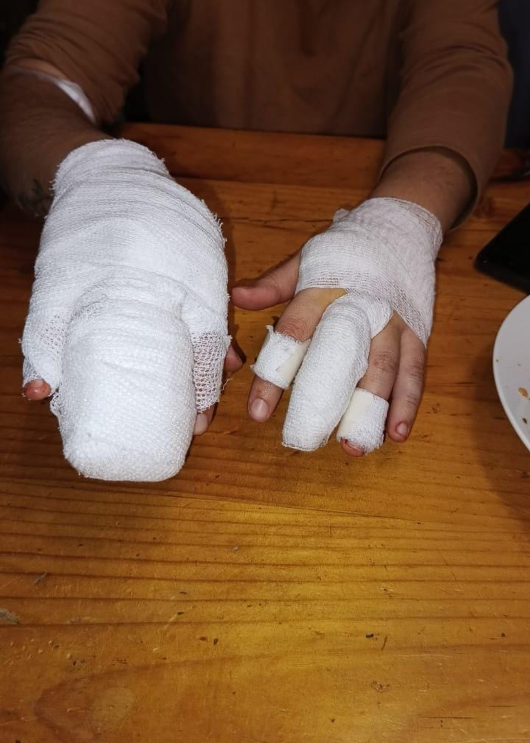 La mujer sufrió heridas cortantes en sus manos y golpes en su antebrazo. La mujer sufrió heridas cortantes en sus manos y golpes en su antebrazo.