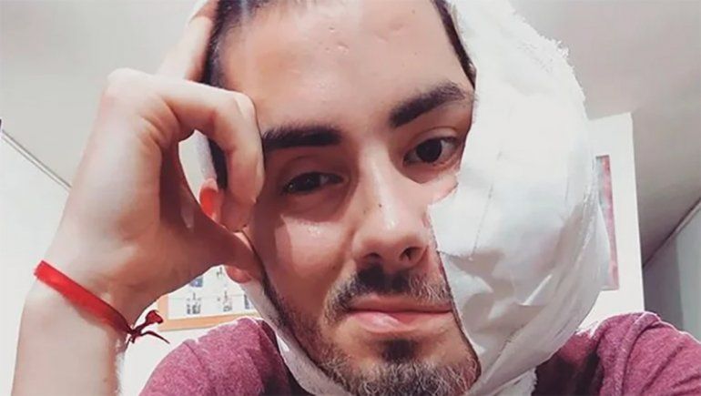 Sebastián contaba en las redes cómo llevaba la enfermedad.