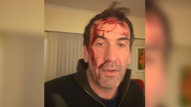 Pablo Cervi, víctima de un violento robo | LM Neuquen Pablo Cervi, víctima de un violento robo