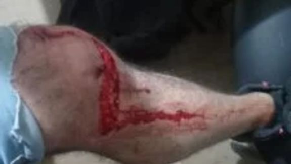 Comodoro Rivadavia: dos dogos lo atacaron en la calle.