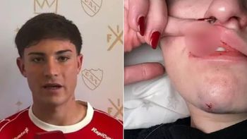 Una mujer relató con crudeza la agreción que sufrió por parte de su expareja, un jugador de la Reserva de Independiente. Una mujer relató con crudeza la agreción que sufrió por parte de su expareja, un jugador de la Reserva de Independiente.