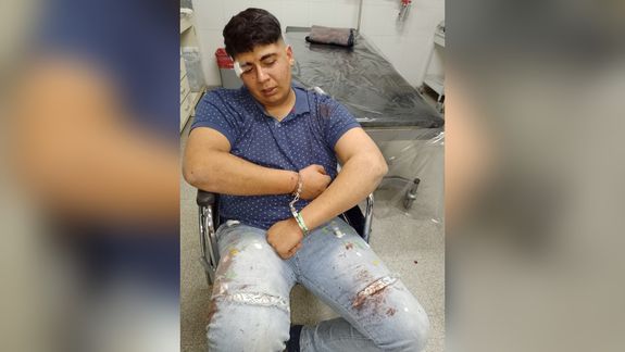 Golpiza a la salida de un boliche: denuncia a la Policía y a un patovica