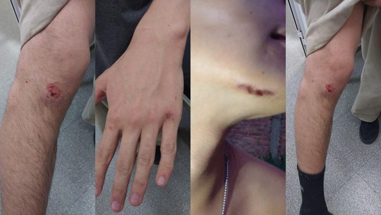 Insultos, patadas y amenazas: denuncian brutal golpiza policial a jóvenes en Junín de los Andes
