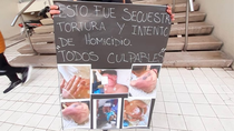 La víctima tiene una discapacidad motriz y no logró defenderse de los golpes. La víctima tiene una discapacidad motriz y no logró defenderse de los golpes.