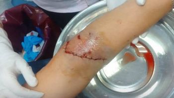 La mujer sufrió heridas de consideración (Foto: Gentileza FM Urbana) La mujer sufrió heridas de consideración (Foto: Gentileza FM Urbana)