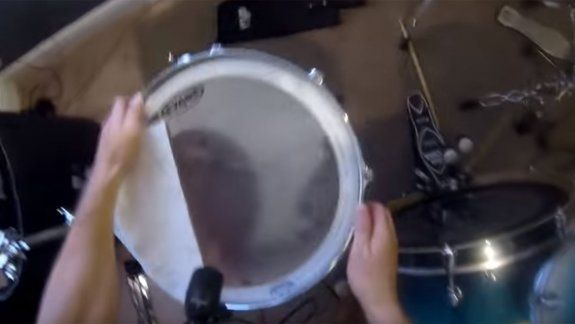 Viral