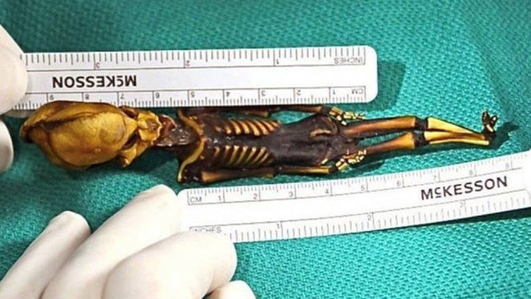 Develan el misterio de Ata, el esqueleto hallado en Atacama