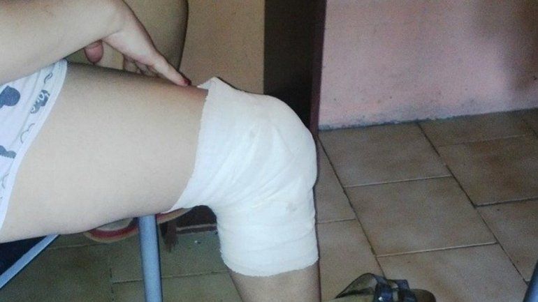 La puerta fue perforada a balazos y uno de ellos hirió a una joven mamá.