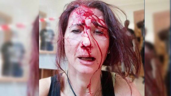 Le pidió que utilice barbijo y recibió una salvaje paliza