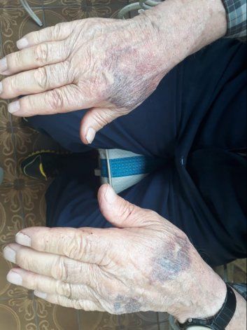 Los delincuentes golpearon a la abuela, de 72 años.