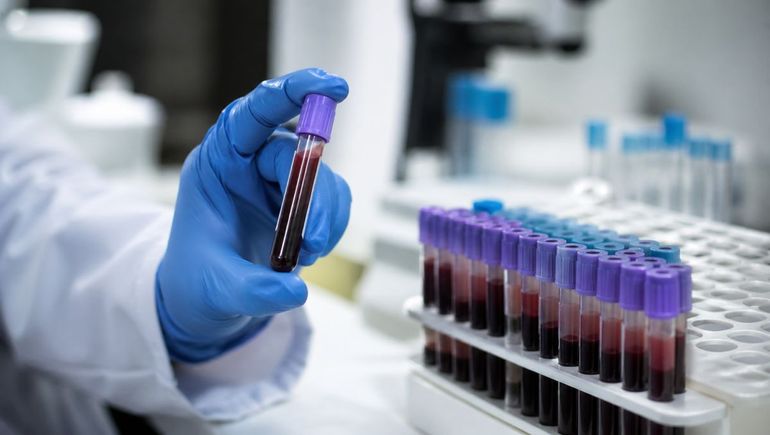 El equipo de Hemoterapia del Hospital Posadas logró identificar estos casos mediante estudios clínicos y serológicos de alta complejidad.