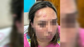 La foto viral corresponde a la subregente golpeada en el IFD 12. 