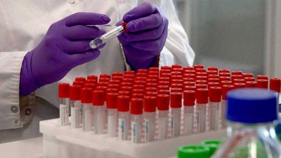 La Anmat autorizó el suero equino para tratar el coronavirus