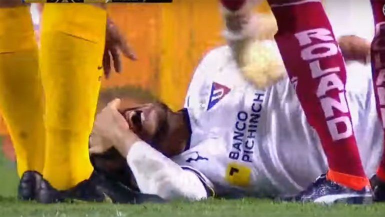 Mirá el momento en el que un jugador de Liga se fractura el tobillo contra Boca