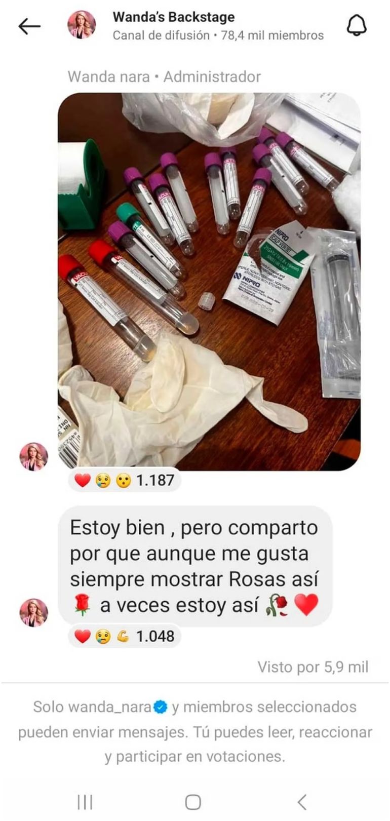 Wanda Nara sorprendió a todos al mostrar por primera vez cómo es el tratamiento que se somete para tratar su salud. Wanda Nara sorprendió a todos al mostrar por primera vez cómo es el tratamiento que se somete para tratar su salud.