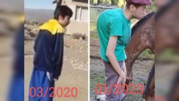 tremendo: asi se deformo la columna de un adolescente que espera ser operado tremendo: asi se deformo la columna de un adolescente que espera ser operado